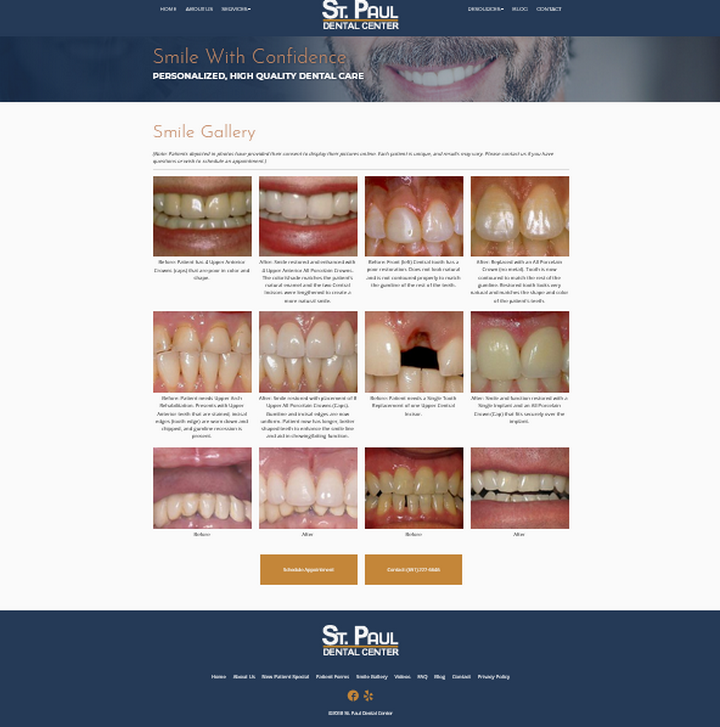 «Галерея улыбок» на сайте St. Paul Dental Center наглядно показывает результаты работы стоматологов «Галерея улыбок» на сайте St. Paul Dental Center наглядно показывает результаты работы стоматологов